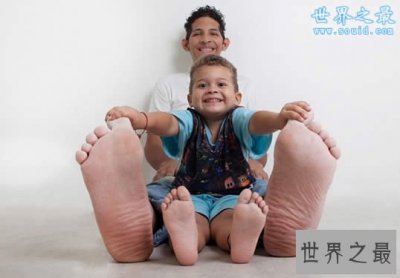 ​世界上脚最长最大的人，脚长达0.4米(图)